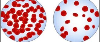 povyshen gemoglobin v krovi